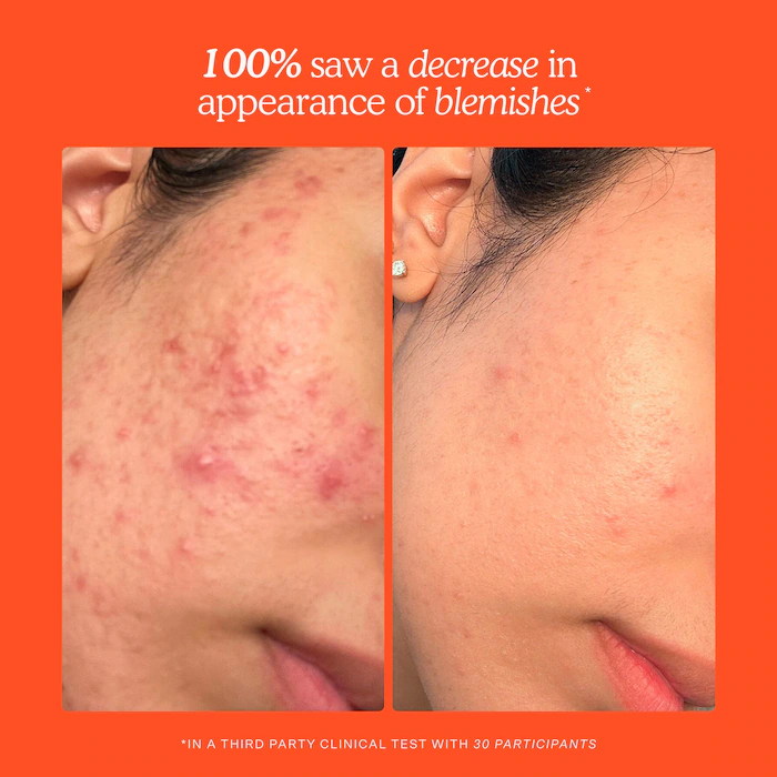 Mini SOS Daily Rescue Facial Spray – Image 12