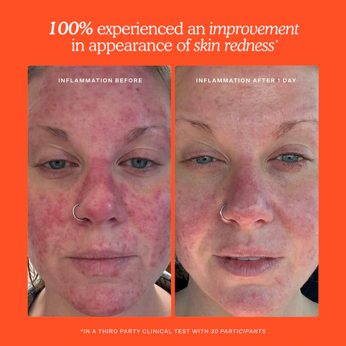 Mini SOS Daily Rescue Facial Spray – Image 11