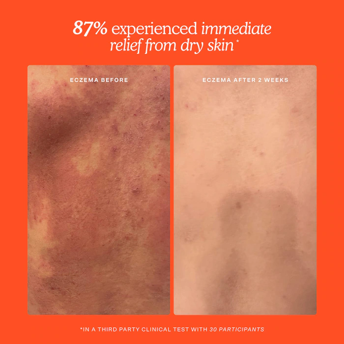 Mini SOS Daily Rescue Facial Spray – Image 10