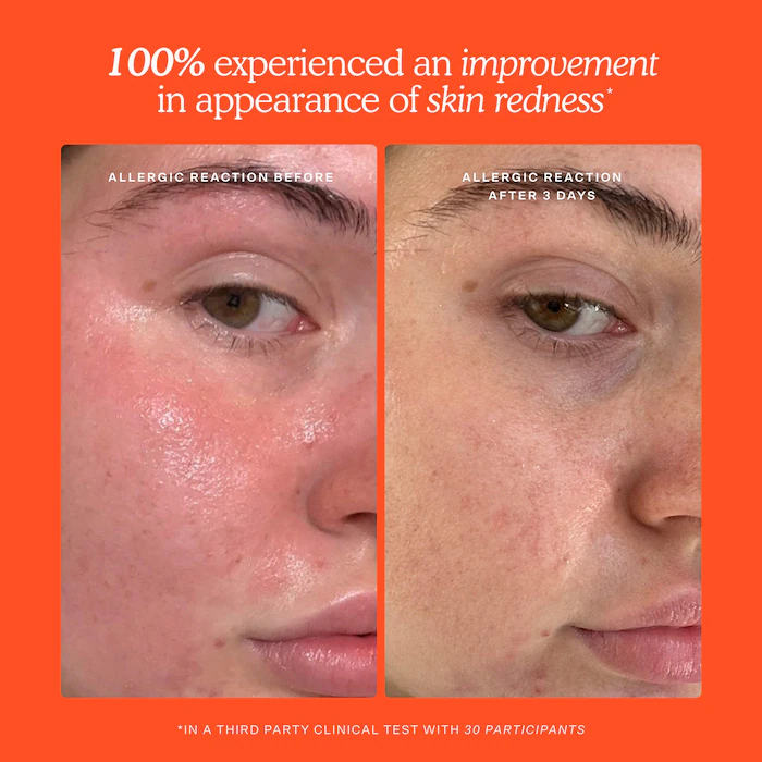 Mini SOS Daily Rescue Facial Spray – Image 8