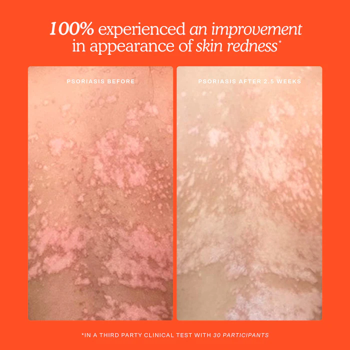 Mini SOS Daily Rescue Facial Spray – Image 7